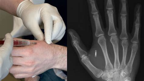 how to find rfid chip|rfid chips in humans.